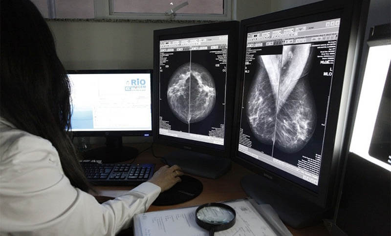 Rio vai realizar mamografias gratuitas durante Outubro Rosa