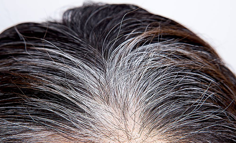 Cabelo branco causado por estresse pode retomar cor original